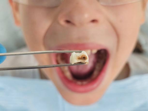 Best Emergency Treatment for Toothache in Elkins Rk, PA